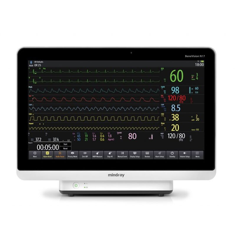 Benevision N17