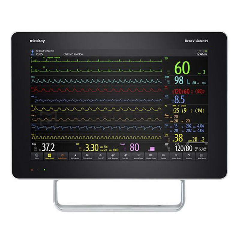 Benevision N19